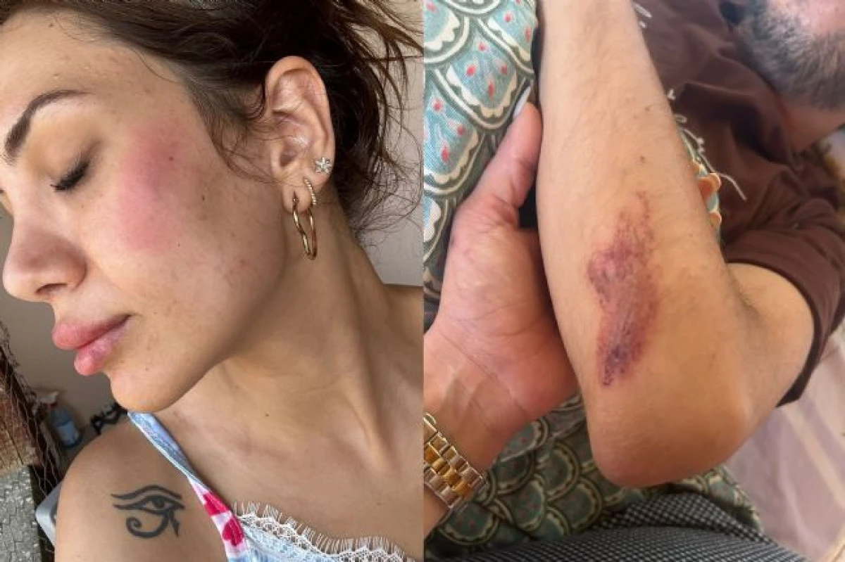 Veteriner Melek Nida Urazan'dan Komşularına Darp İddiası