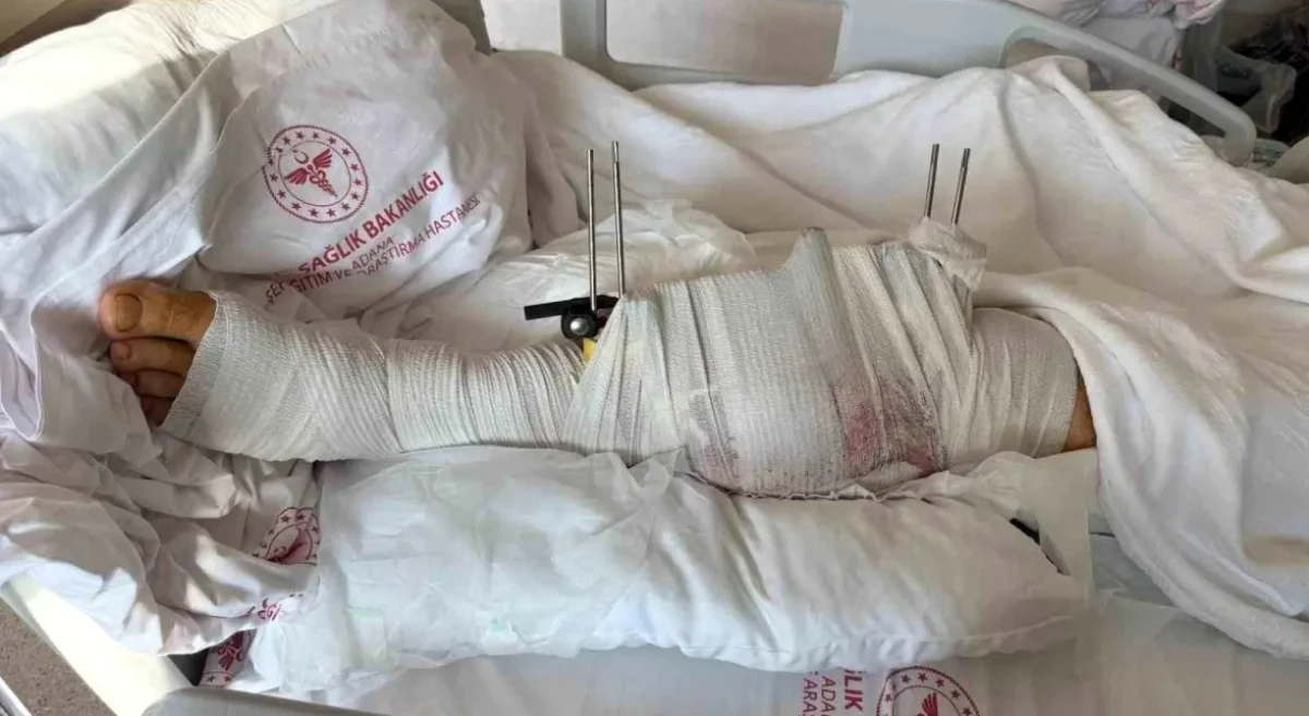 Muhtar, Eski Damadını Tabancayla Vurarak Yaraladı