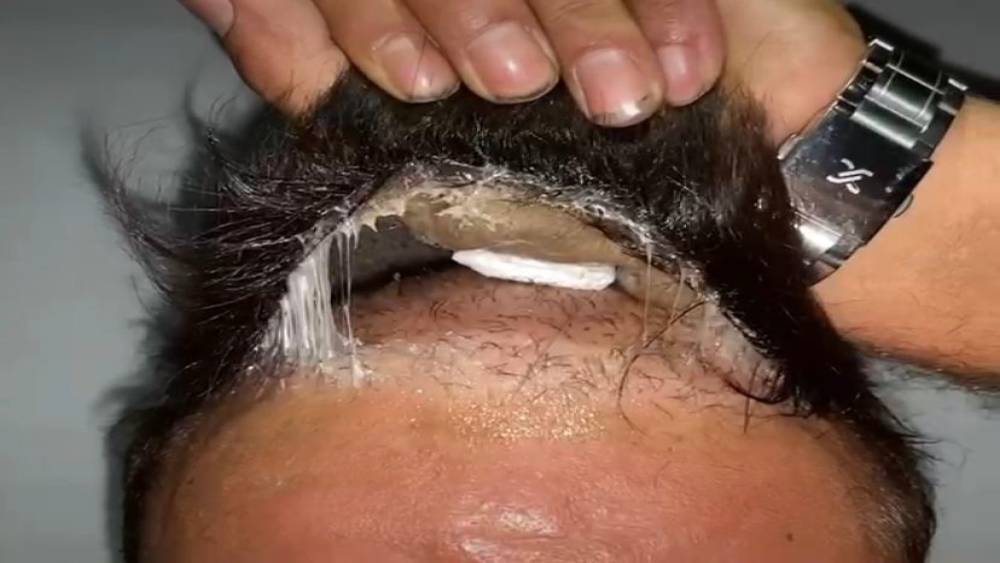ŞÜPHELİNİN PERUĞUNDAN UYUŞTURUCU ÇIKTI