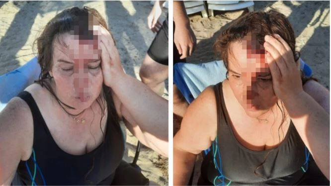 DENİZDE YÜZERKEN KANLAR İÇİNDE KALDI! ÇARPAN KİŞİ KÜFÜRÜ BASIP KAÇTI