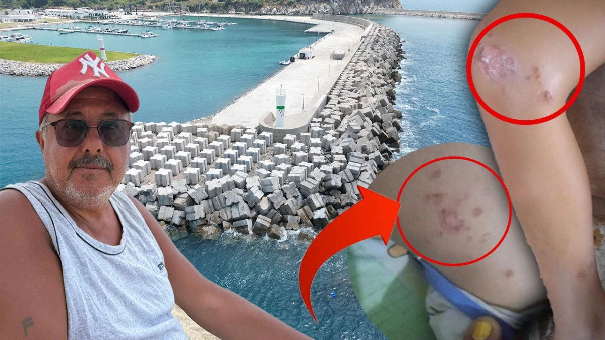Antalya'da Denizde Çocukta Enfeksiyon Şüphesi, Atık Su Borusu Ele Geçirildi