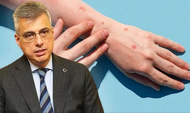 BAKAN MEMİŞOĞLU'NDAN MAYMUN ÇİÇEĞİYLE İLGİLİ YÜREKLERE SU SERPEN SÖZLER